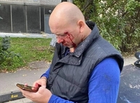 Вихідці з Донецька побили учасника АТО з дружиною (ФОТО)