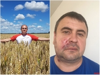 Федорчук каже, що не замовляв побиття депутата Немеша у Рівному 
