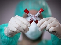 Фахівці назвали причину «коронавірусного антирекорду» Рівненщини 