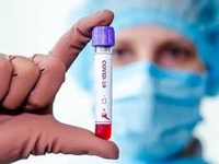 На Рівненщині вже 63 медпрацівники - з коронавірусом