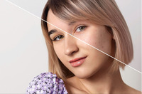 ТОП-методи боротьби з пігментацією: домашній догляд, косметологія та профілактика