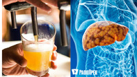 Що чекає печінку, якщо пити пиво щодня: пояснення лікаря 